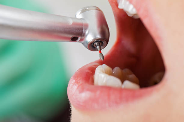 Best Emergency Dentist for Special Needs Patients in Fort Totten, ND